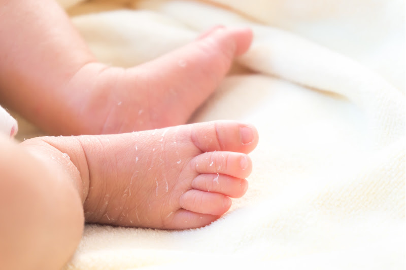 Newborns' skin peeling